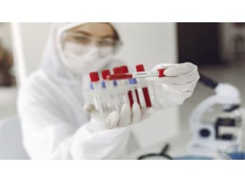 ІФА аналіз на COVID-19. Виявлення антитіл Ig М та Ig G