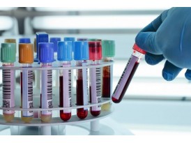 Серологічний аналіз крові: що показує та як підготуватися Серологічний аналіз крові: що показує та як підготуватися
