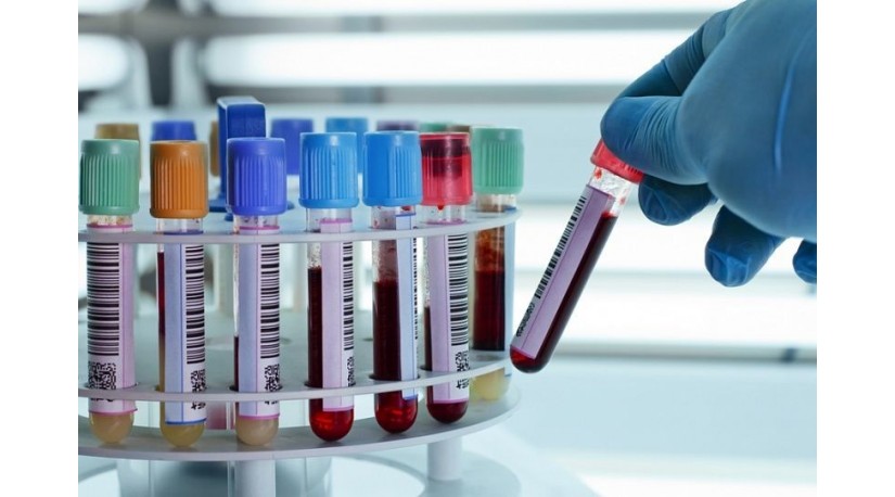 Серологічний аналіз крові: що показує та як підготуватися Серологічний аналіз крові: що показує та як підготуватися