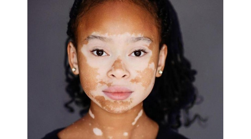 Боротьба з собою: аутоімунні захворювання й їх діагностика Боротьба з собою: аутоімунні захворювання й їх діагностика