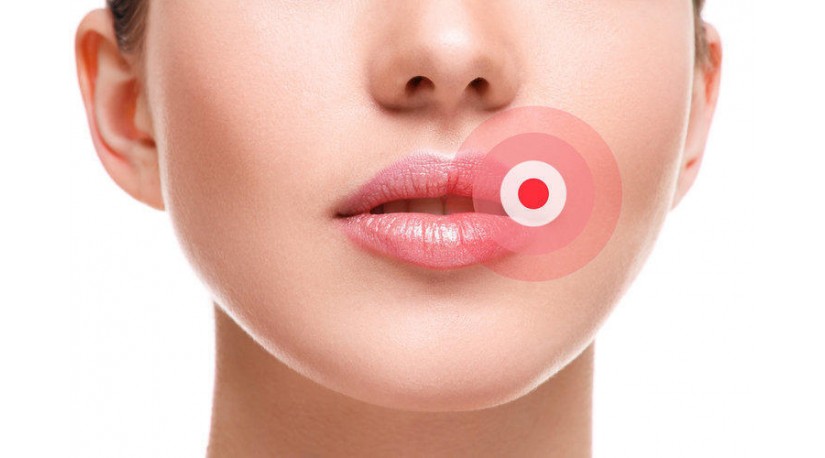 Міжнародний тиждень герпесу Міжнародний тиждень герпесу