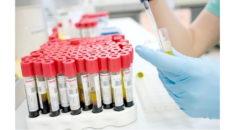 Що може розповісти аналіз на онкомаркери Що може розповісти аналіз на онкомаркери