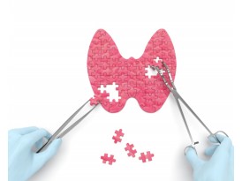 Пора проверить щитовидную железу Пора проверить щитовидную железу