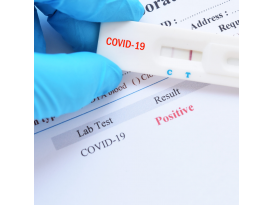 Быстрый тест на антиген SARS-CoV-2