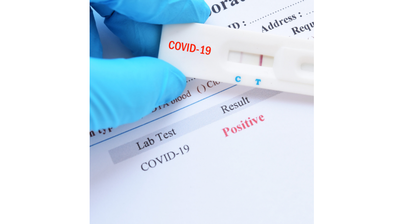 Быстрый тест на антиген SARS-CoV-2